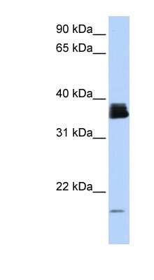 Western Blot: Cyclophilin A Antibody [NBP1-54401]