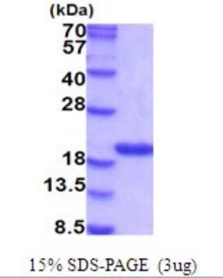 SDS-PAGE: Recombinant Mouse Cyclophilin A His Protein [NBP2-51988]