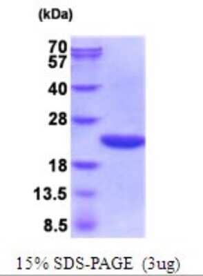 SDS-PAGE: Recombinant E. coli Cyclophilin A His Protein [NBP2-51990]