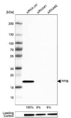 Western Blot: Cyclophilin B Antibody (CL3915) [NBP2-59782]