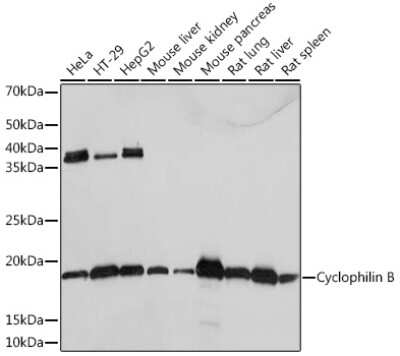 Western Blot: Cyclophilin B Antibody (7Z4S7) [NBP3-16494]