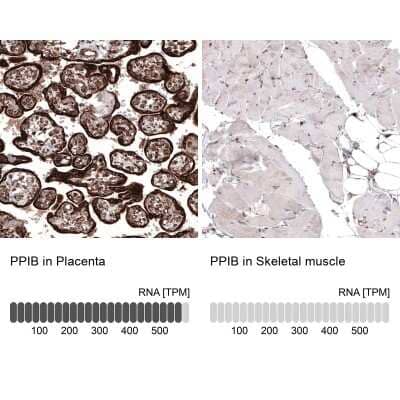 Immunohistochemistry-Paraffin: Cyclophilin B Antibody (CL3901) [NBP2-59781]