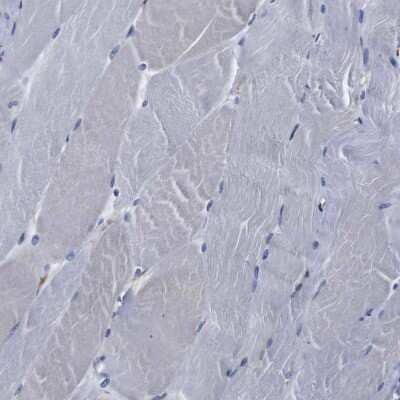 Immunohistochemistry-Paraffin: Cyclophilin B Antibody [NBP1-85358]