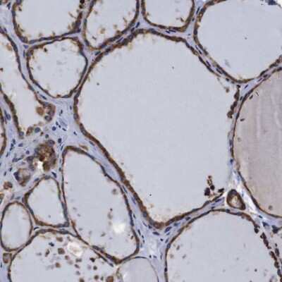 Immunohistochemistry-Paraffin: Cyclophilin B Antibody [NBP1-85358]