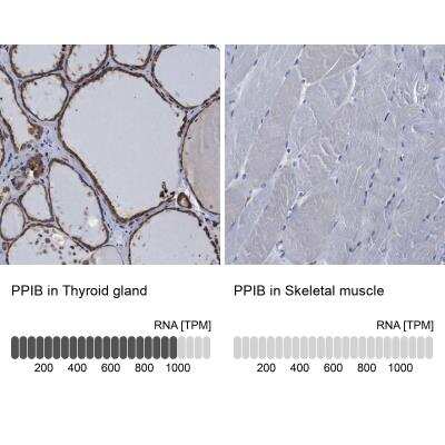 Immunohistochemistry-Paraffin: Cyclophilin B Antibody [NBP1-85358]