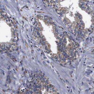 Immunohistochemistry-Paraffin: Cyclophilin B Antibody [NBP1-85358]