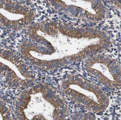 Immunohistochemistry-Paraffin: Cyclophilin B Antibody [NBP1-85358]