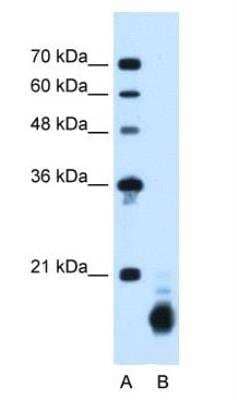 Western Blot: Cyclophilin B Antibody [NBP1-62356]