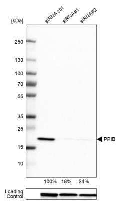 Western Blot: Cyclophilin B Antibody [NBP1-85358]