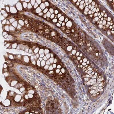 Immunohistochemistry-Paraffin: Cyclophilin C Antibody [NBP2-13793]