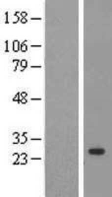 Western Blot: Cyclophilin C Overexpression Lysate [NBL1-14647]