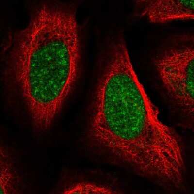 Immunocytochemistry/ Immunofluorescence: Cyclophilin-E Antibody [NBP2-55449]