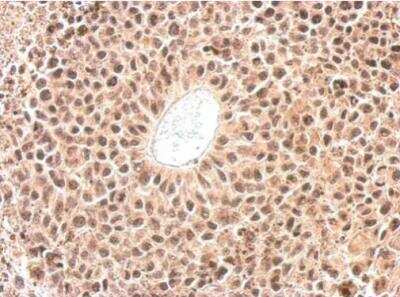 Immunohistochemistry-Paraffin: Cyclophilin-E Antibody [NBP1-33471]