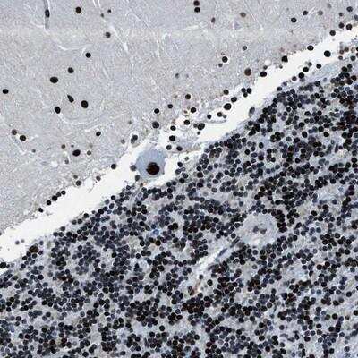 Immunohistochemistry-Paraffin: Cyclophilin-E Antibody [NBP1-85365]