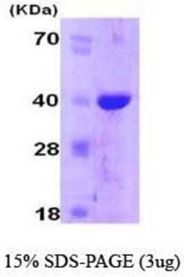 SDS-PAGE: Recombinant Human Cyclophilin-E His Protein [NBC1-18531]