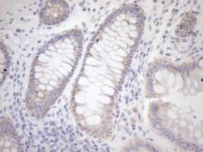 Immunohistochemistry: Cyclophilin-F Antibody (OTI1G8) [NBP2-45380]
