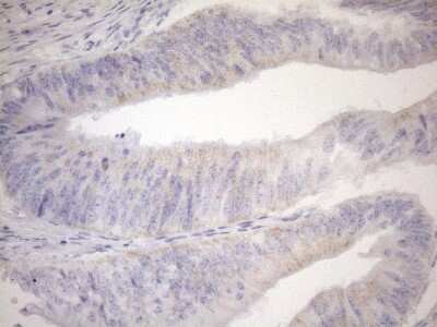 Immunohistochemistry: Cyclophilin-F Antibody (OTI1G8) [NBP2-45380]