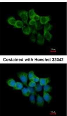 Immunocytochemistry/ Immunofluorescence: Cyclophilin-F Antibody [NBP2-15079]