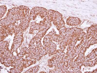 Immunohistochemistry-Paraffin: Cyclophilin-F Antibody [NBP2-15079]