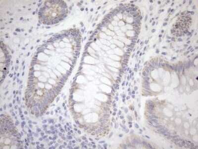 Immunohistochemistry: Cyclophilin-F Antibody (OTI1G8) - Azide and BSA Free [NBP2-71551]