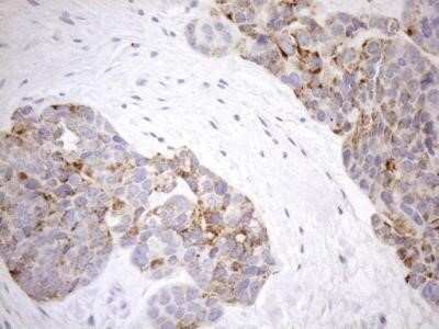Immunohistochemistry: Cyclophilin-F Antibody (OTI1G8) - Azide and BSA Free [NBP2-71551]
