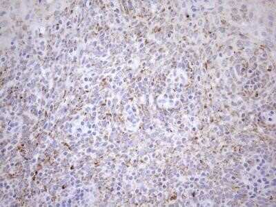Immunohistochemistry: Cyclophilin-F Antibody (OTI1G8) - Azide and BSA Free [NBP2-71551]
