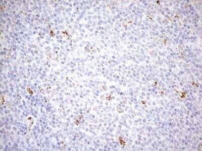 Immunohistochemistry: Cyclophilin-F Antibody (OTI1G8) [NBP2-45380]
