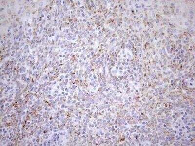 Immunohistochemistry: Cyclophilin-F Antibody (OTI1G8) [NBP2-45380]