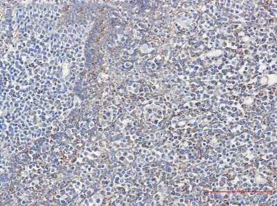 Immunohistochemistry-Paraffin: Cyclophilin-F Antibody (S02-6I9) [NBP3-14923]