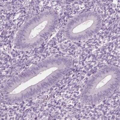 Immunohistochemistry-Paraffin: Cylicin 1 Antibody [NBP2-56428]