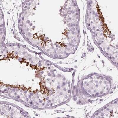 Immunohistochemistry-Paraffin: Cylicin 1 Antibody [NBP2-56428]