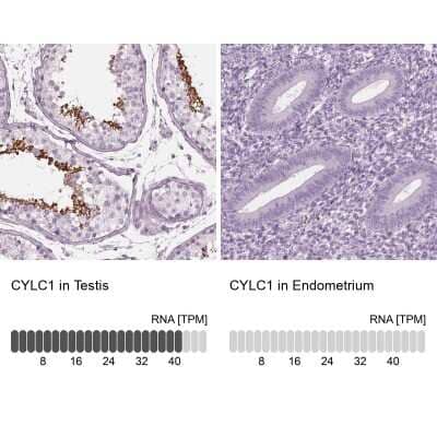 Immunohistochemistry-Paraffin: Cylicin 1 Antibody [NBP2-56428]