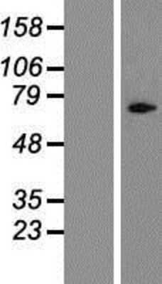 Western Blot: Cylicin 1 Overexpression Lysate [NBP2-06565]