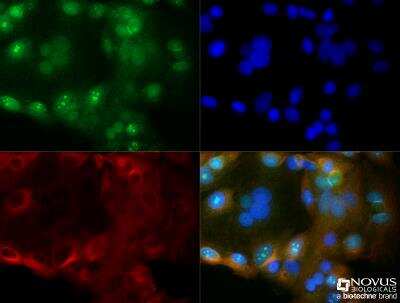 Immunocytochemistry/ Immunofluorescence: Cyr61/CCN1 Antibody - BSA Free [NB100-356]