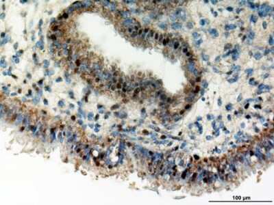 Immunohistochemistry: Cyr61/CCN1 Antibody - BSA Free [NB100-356]
