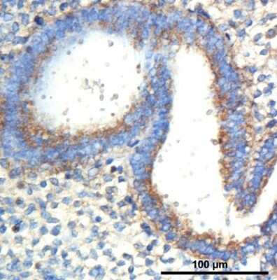 Immunohistochemistry: Cyr61/CCN1 Antibody - BSA Free [NB100-356]