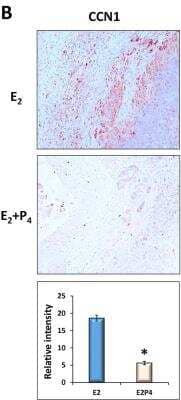 Immunohistochemistry: Cyr61/CCN1 Antibody - BSA Free [NB100-356]