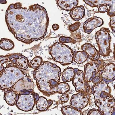 Immunohistochemistry-Paraffin: Cysteinyl Leukotriene R2/CysLTR2 Antibody [NBP2-13897]