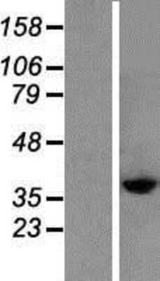 Western Blot: Cysteinyl Leukotriene R2/CysLTR2 Overexpression Lysate [NBP2-06656]