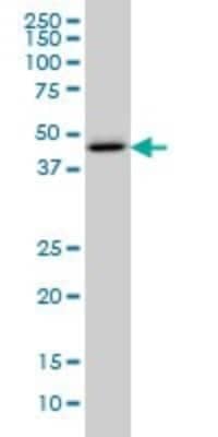 Western Blot: Cystathionase Antibody (2E12-1C10) [H00001491-M02]