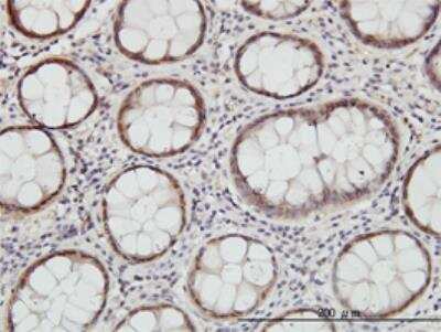 Immunohistochemistry-Paraffin: Cystathionase Antibody (4E1-1B7) [H00001491-M01]