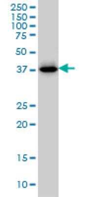 Western Blot: Cystathionase Antibody (4E1-1B7) [H00001491-M01]