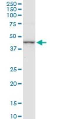 Western Blot: Cystathionase Antibody (4E1-1B7) [H00001491-M01]
