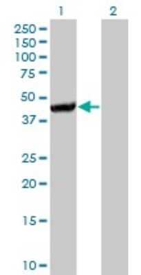 Western Blot: Cystathionase Antibody (4E1-1B7) [H00001491-M01]