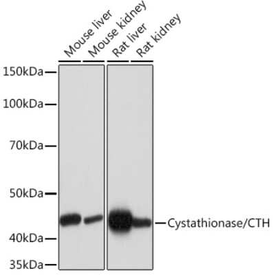 Western Blot: Cystathionase Antibody (7L3D0) [NBP3-16554]