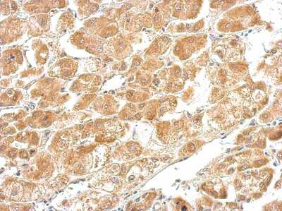 Immunohistochemistry-Paraffin: Cystathionase Antibody [NBP1-31759]