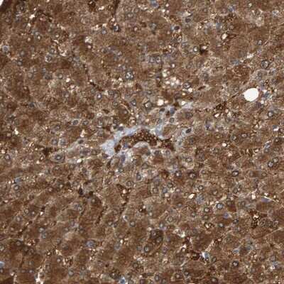 Immunohistochemistry-Paraffin: Cystathionase Antibody [NBP1-86016]