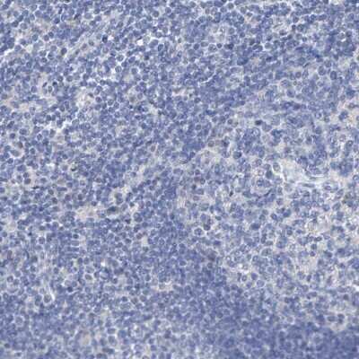 Immunohistochemistry-Paraffin: Cystathionase Antibody [NBP1-86016]