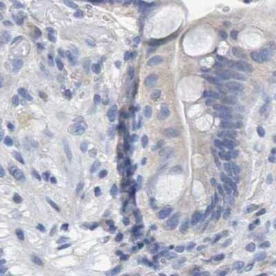 Immunohistochemistry-Paraffin: Cystathionase Antibody [NBP1-86016]