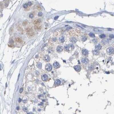 Immunohistochemistry-Paraffin: Cystathionase Antibody [NBP1-86016]